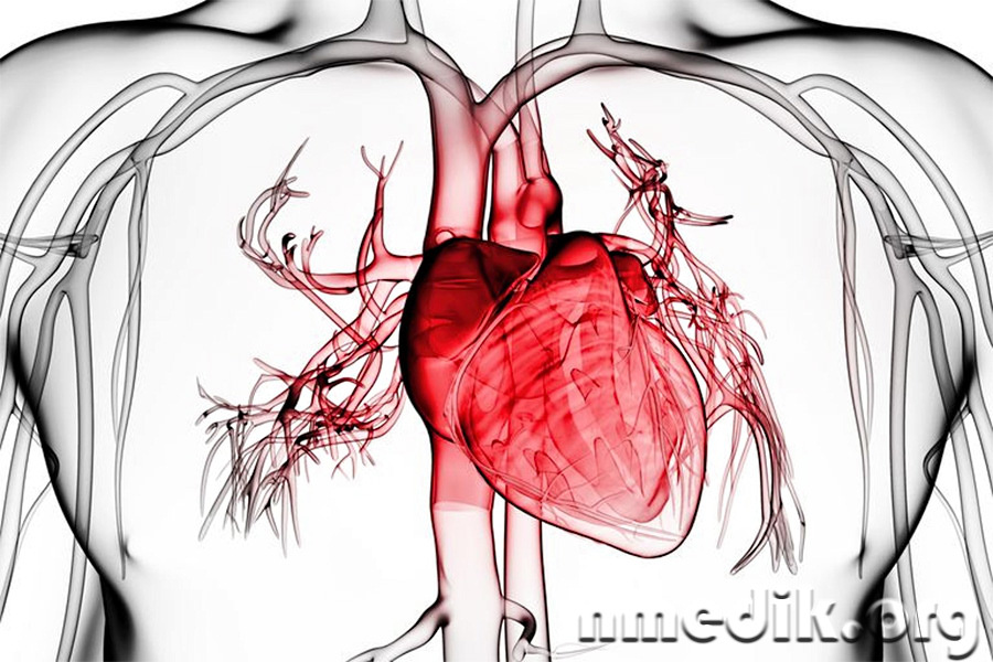 Кардит - воспаление оболочки сердца